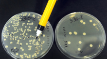 Eine Biologielaborantin wertet in einem Labor Hefepilze von Rohmilch auf selektive Nährmedien aus. Foto: Waltraud Grubitzsch/Dpa-zentralbild/dpa 