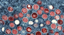 Eine eingefärbte Mikroskopaufnahme von mpox-Partikeln (rot) in einer infizierten Zelle (blau), die im Labor kultiviert wurde. Foto: National Institute of Allergy and Infectious Diseases/Ap/dpa