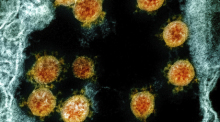 Partikel des Coronavirus SARS-CoV-2 wurden für eine elektronenmikroskopische Aufnahme am «National Institute of Allergy and Infectious Diseases Integrated Research Facility» farblich bearbeitet. oto: Uncredited/NIAID/NIH/dpa