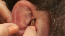 Ein Hörgerät wird in ein Ohr eingesetzt. Foto: Thomas Frey/dpa