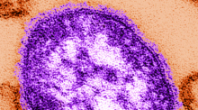 Eine undatierte Abbildung, die mit Hilfe eines Transmissionselektronenmikroskops gemacht wurde, zeigt Teile eines Masernvirus. Foto: Cynthia Goldsmith/Centers For Disease Control And Prevention/dpa