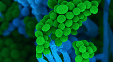 Der Schimmelpilz Penicillium ist Mikrobe des Jahres 2026. Sein Name bezieht sich auf die pinselartigen Zellketten mit Sporen. Foto: dpa/Ulrich Kück/birgit Hoff
