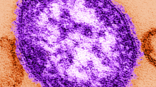 Eine undatierte Abbildung, die mit Hilfe eines Transmissionselektronenmikroskops genmacht wurde, zeigt Teile eines Masernvirus. Foto: Cynthia Goldsmith/Centers For Disease Control And Prevention/dpa