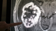 In der Diagnostik der Radiologie der Universitätsmedizin Rostock wird mit Hilfe der Magnetresonanztomographie ein Tumor festgestellt. Foto: Bernd Wüstneck/dpa-zentralbild/dpa