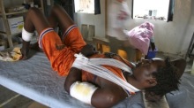 Ein Sudanese mit Schusswunden in der Klinik von Ärzte ohne Grenzen (MSF), während das Personal eifrig seiner Arbeit nachgeht. Foto: epa/Nic Bothma