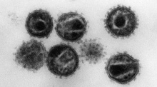 Elektronenmikroskopische Aufnahme mehrerer HIV (Humane Immunschwäche-Viren) Erreger der Immunschwäche-Krankheit Aids. Foto: Hans Gelderblom/Robert Koch Institut/dpa