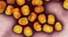Eine kolorierte transmissionselektronenmikroskopische Aufnahme von Partikeln des Affenpockenvirus (Gold). Foto: Niaid/Niaid/planet Pix Via Zuma Press Wire/dpa