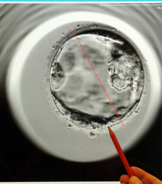 Auf einem Bildschirm ist ein mit einem EmbryoScope aufgenommener fünf Tage alter Embryo abgebildet. Foto: Waltraud Grubitzsch/Dpa-zentralbild/dpa