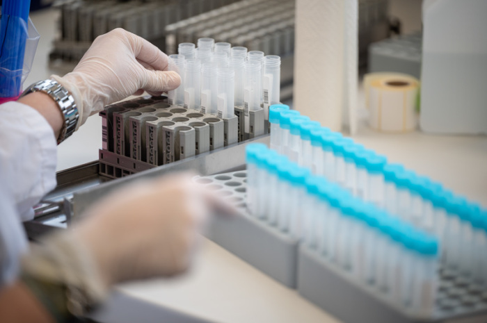 Eine Labormitarbeiterin bereitet im Bioscientia MVZ Labor Mittelhessen Teströhrchen für einen PCR-Test vor. Innerhalb eines Tages ist die Zahl der sicher nachgewiesenen und wahrscheinlichen Omikron-Fälle in Deutschl... Foto: Sebastian Gollnow/dpa