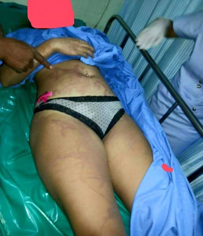 Diese Thaifrau erlitt durch den Quallenbiss schwere Hautverbrennungen und starb wenige Stunden darauf im Krankenhaus auf der Ferieninsel Koh Phangan.