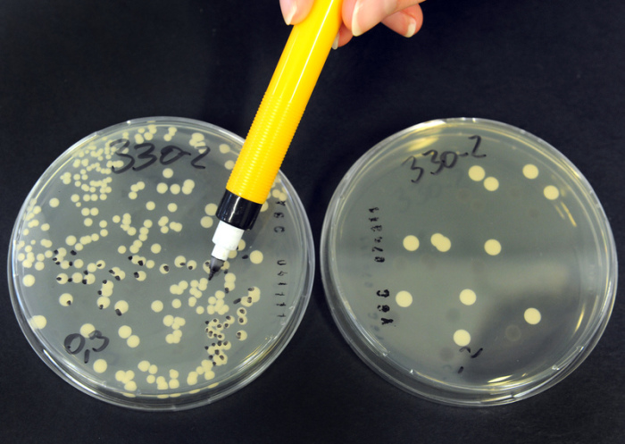 Eine Biologielaborantin wertet in einem Labor Hefepilze von Rohmilch auf selektive Nährmedien aus. Foto: Waltraud Grubitzsch/Dpa-zentralbild/dpa 