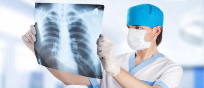 Bei der Lungentuberkulose kommt es zu krankhaften Veränderungen in der Lunge, die zu einem Husten mit blutigem Auswurf führen können.