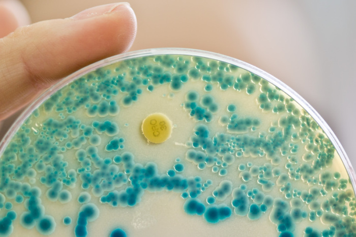 Eine Labormitarbeiterin an einem Institut für Klinische Mikrobiologie, Immunologie und Hygiene hält im Diagnostiklabor eine Indikatorkulturplatte zum Nachweis von resistenten Bakterien in der Hand. Foto: Daniel Karmann/Dpa 