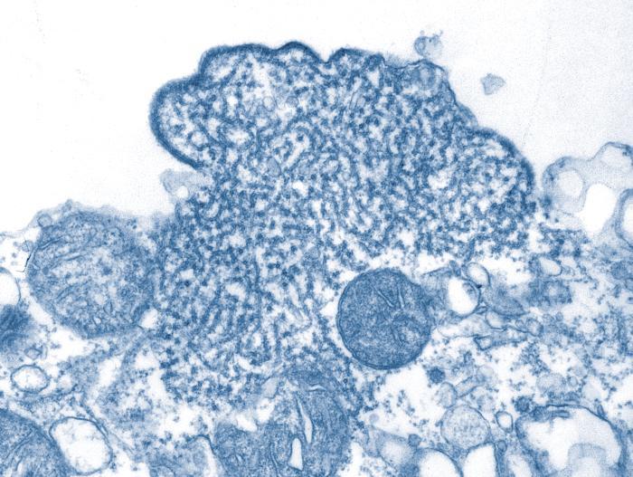 Diese transmissionselektronenmikroskopische Aufnahme (TEM) zeigte eine Anzahl von Nipah-Virus-Virionen, die aus der Liquorprobe eines Patienten isoliert worden waren. Foto: Wikimedia/Cdc/ C. S. Goldsmith, P. E. Rollin