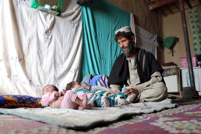 Ein Vater von neugeborenen Drillingen, Ehsanullah, sitzt neben seinen Babys in seinem Haus in Kandahar. Foto: epa/Str