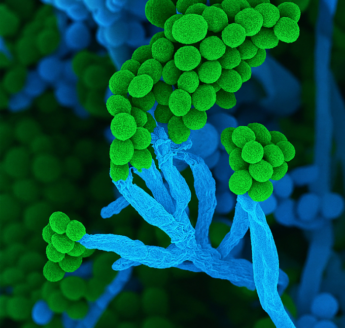 Der Schimmelpilz Penicillium ist Mikrobe des Jahres 2026. Sein Name bezieht sich auf die pinselartigen Zellketten mit Sporen. Foto: dpa/Ulrich Kück/birgit Hoff