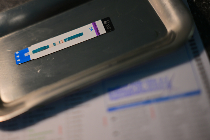 Ein HIV-Schnelltest in der Berliner Aids-Hilfe steht symbolisch für die laut RKI rund 2.300 neuen HIV-Infektionen im vergangenen Jahr. Foto: dpa/Sebastian Gollnow