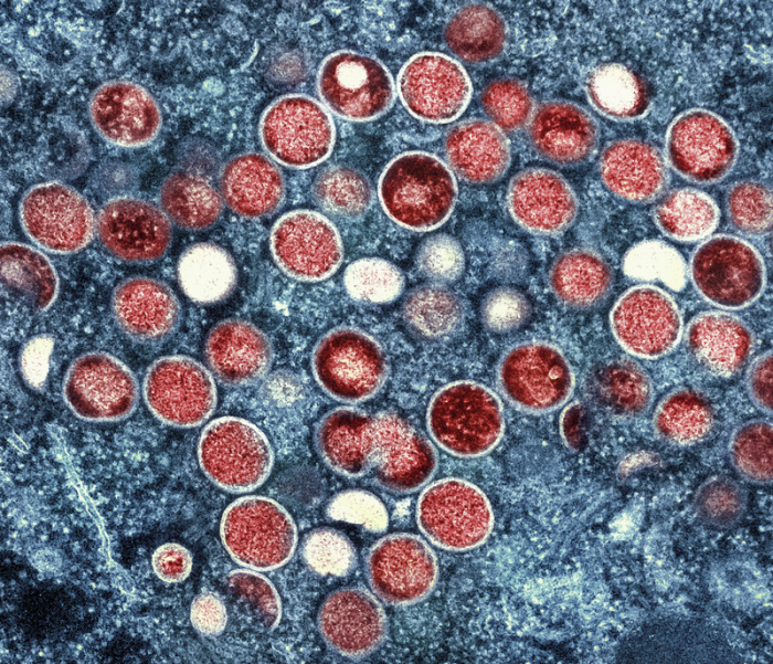 Eine eingefärbte Mikroskopaufnahme von Mpox-Partikeln (rot) in einer infizierten Zelle (blau), die im Labor kultiviert wurde. Foto: National Institute of Allergy and Infectious Diseases/Ap/dpa