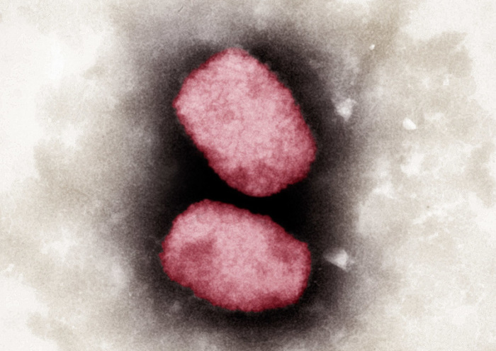 Elektronenmikroskopische Aufnahme von Affenpocken-Viren, koloriert (Bestmögliche Bildqualität). Affenpocken werden laut Robert Koch-Institut (RKI) durch engen Körperkontakt von Mensch zu Mensch übertragen. Foto: Andrea Männel
