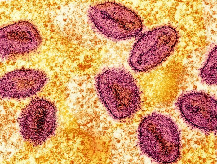 Foto: Unsplash/National Institute Of Allergy And Infectious Diseases