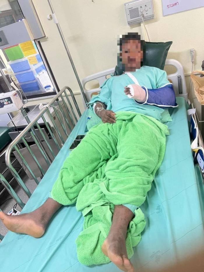 Ein verletzter Arbeiter liegt im Krankenhaus Chanthaburi – er wurde von einem wilden Elefanten angegriffen. Bild: Department of National Parks, Wildlife and Plant Conservation (DNP)