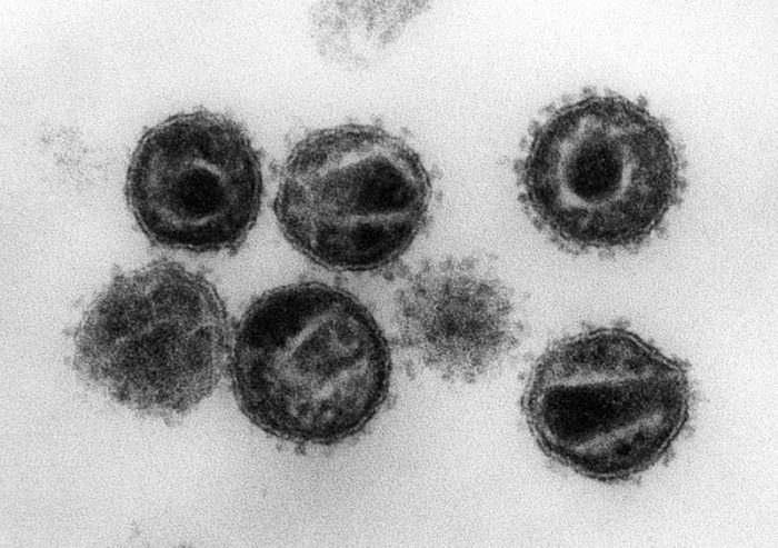 Elektronenmikroskopische Aufnahme mehrerer HIV (Humane Immunschwäche-Viren) Erreger der Immunschwäche-Krankheit Aids. Foto: Hans Gelderblom/Robert Koch Institut/dpa