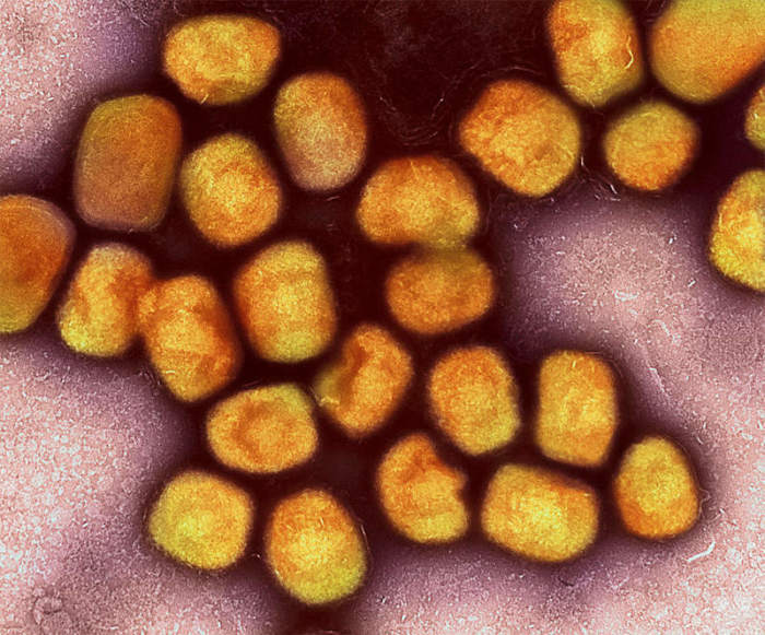 Eine kolorierte transmissionselektronenmikroskopische Aufnahme von Partikeln des Affenpockenvirus (Gold). Foto: Niaid/Niaid/planet Pix Via Zuma Press Wire/dpa